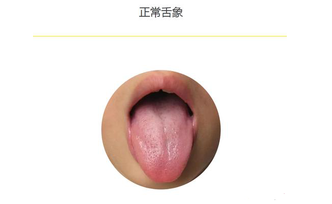 舌头是孩子健康状况的“晴雨表”|中医儿科专家教你舌诊辨别宝宝病因 - 海南省妇女儿童医学中心(海南省妇幼保健院、海南省儿童医院、海南省妇产科医院)